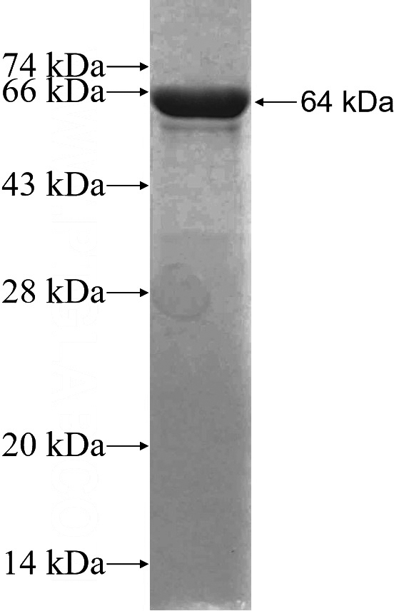 Recombinant Human PLEC SDS-PAGE