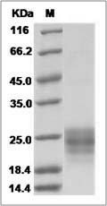 Rat IL9 / IL-9 Protein (His Tag) SDS-PAGE
