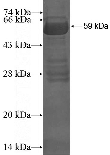 Recombinant Human GORASP2 SDS-PAGE