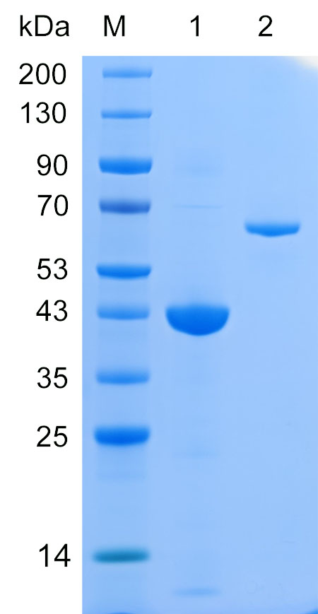Recombinant KIF5C protein (His tag) SDS-PAGE