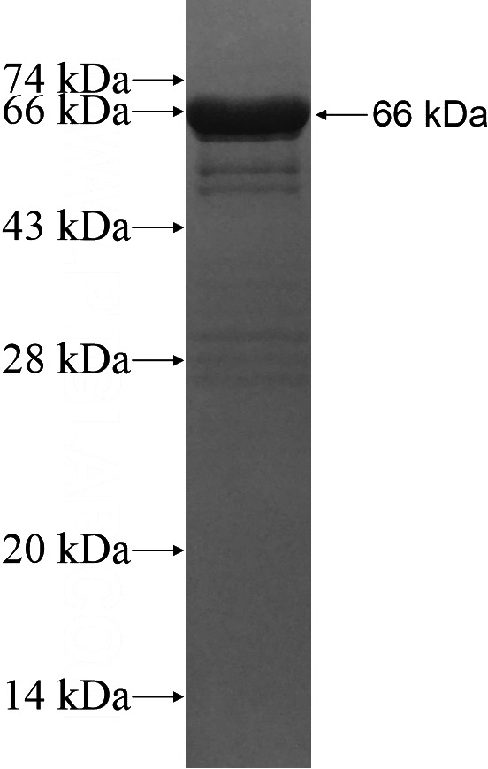 Recombinant Human BAIAP2 SDS-PAGE