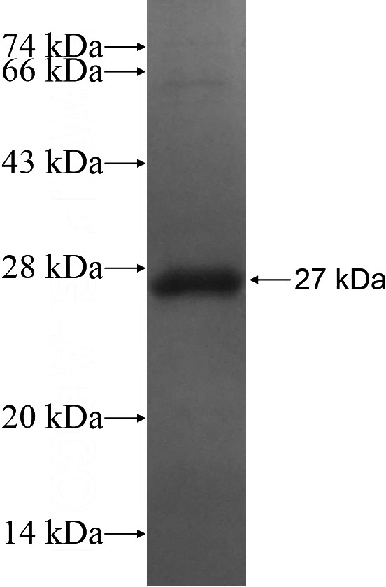 Recombinant Human CRYBA2 SDS-PAGE