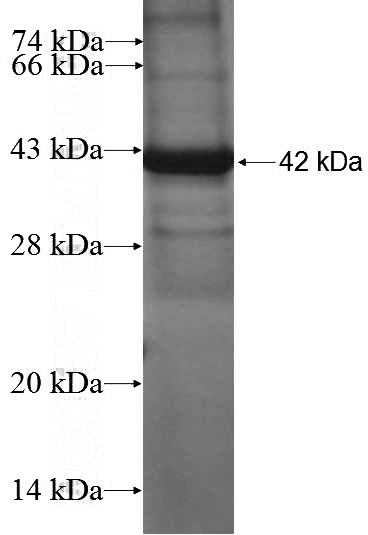 Recombinant Human MYO9B SDS-PAGE