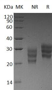 Human FLT3LG (His tag) recombinant protein