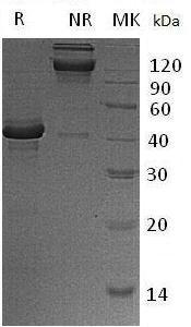 Mouse Tnfrsf13b/Taci (Fc tag) recombinant protein