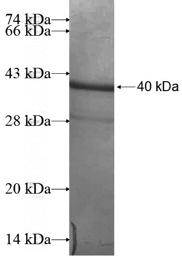 Recombinant Human ALMS1 SDS-PAGE