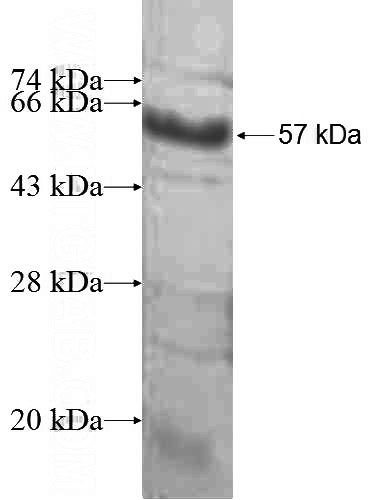 Recombinant Human MAGEA8 SDS-PAGE