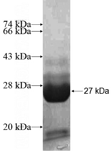 Recombinant Human MRPL11 SDS-PAGE
