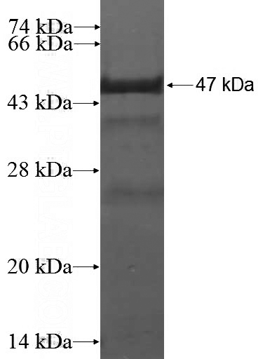Recombinant Human PKP2 SDS-PAGE