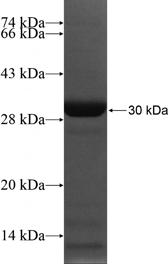 Recombinant Human XPO1 SDS-PAGE