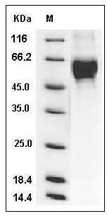 Influenza A H9N2 (A/Guinea fowl/Hong Kong/WF10/99) Hemagglutinin Protein (HA1 Subunit) (His Tag) SDS-PAGE