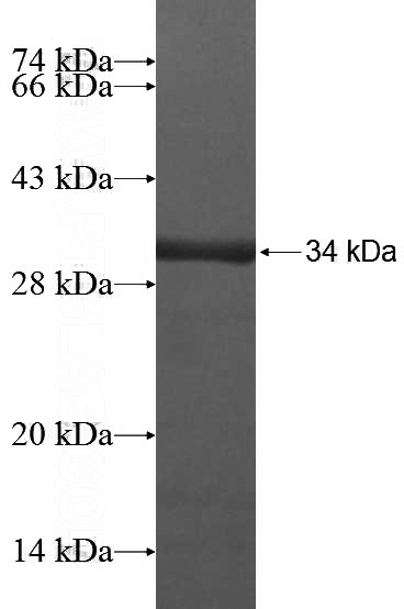 Recombinant Human C10orf63 SDS-PAGE