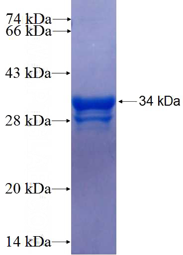 Recombinant Human USP4 SDS-PAGE