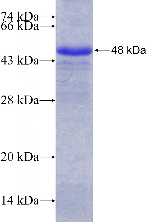 Recombinant Human SKIL SDS-PAGE