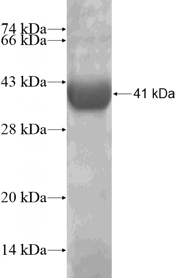 Recombinant Human SAMHD1 SDS-PAGE