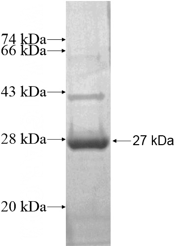 Recombinant Human MLF1IP SDS-PAGE