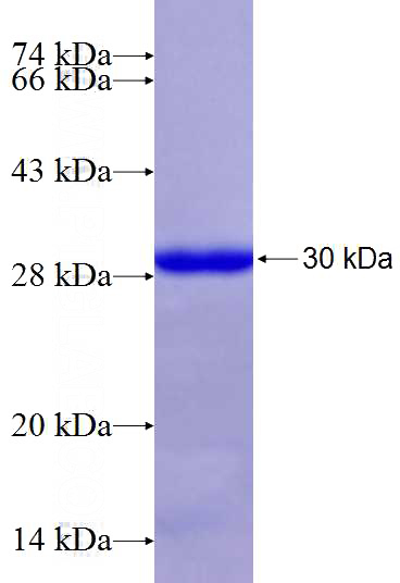 Recombinant Human ACOT2 SDS-PAGE