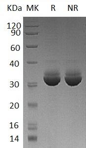 Human CELA3A/ELA3/ELA3A (His tag) recombinant protein