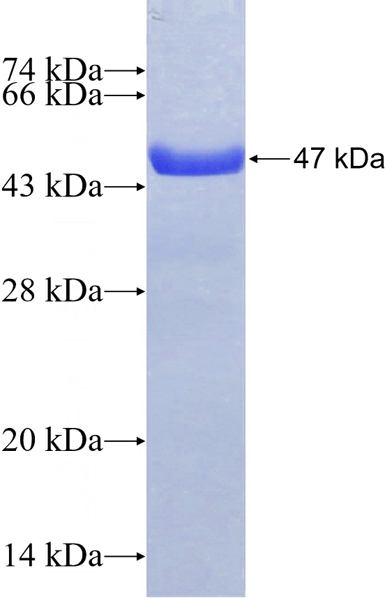 Recombinant Human BICD2 SDS-PAGE