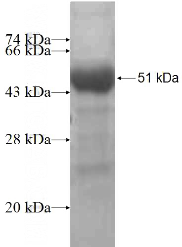 Recombinant Human LARP4 SDS-PAGE