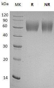 Mouse Pvr/D7Ertd458e/Tage4/mCG_4885 (His tag) recombinant protein