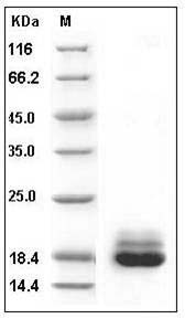 Human Cystatin C / CST3 Protein (His Tag) SDS-PAGE