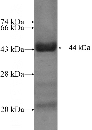 Recombinant Human ASB6 SDS-PAGE