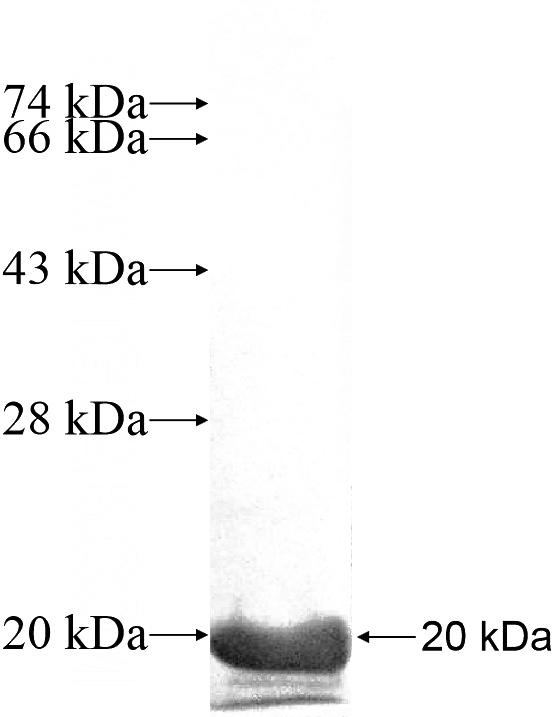 Recombinant Human MYLPF SDS-PAGE