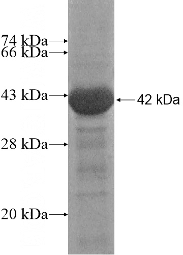 Recombinant Human CYTIP SDS-PAGE