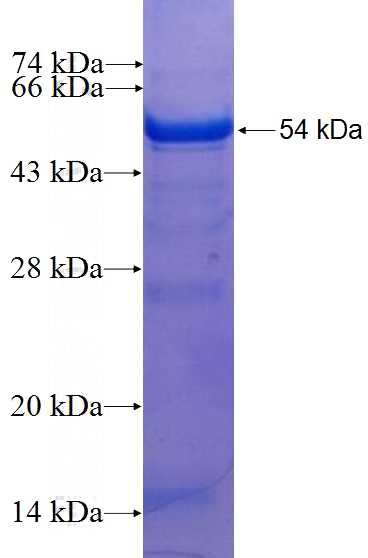 Recombinant Human CC2D1A SDS-PAGE