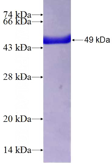 Recombinant Human RAB1A SDS-PAGE