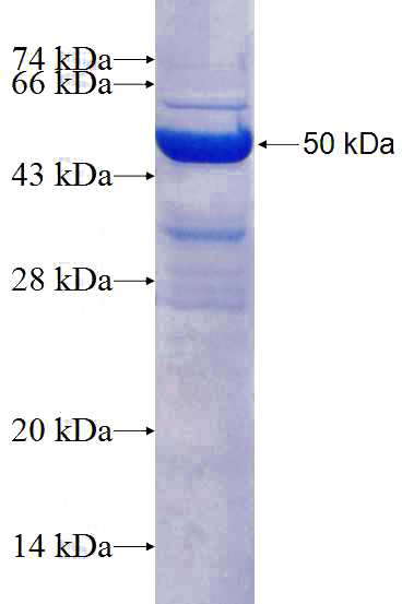 Recombinant Human IL-1F7 SDS-PAGE
