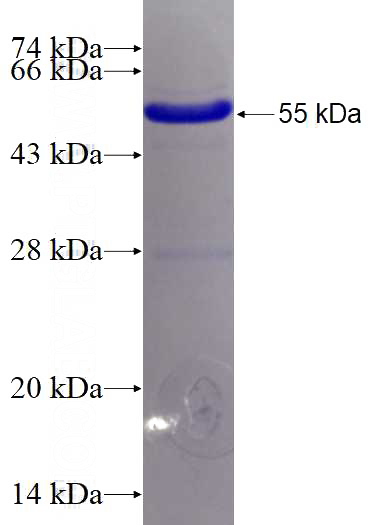 Recombinant Human GGH SDS-PAGE
