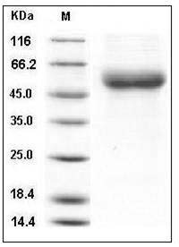 Human IL18RAP / IL1R7 Protein (His Tag) SDS-PAGE