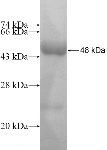 Recombinant Human PLCD3 SDS-PAGE