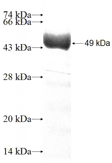 Recombinant Human GTPBP6 SDS-PAGE