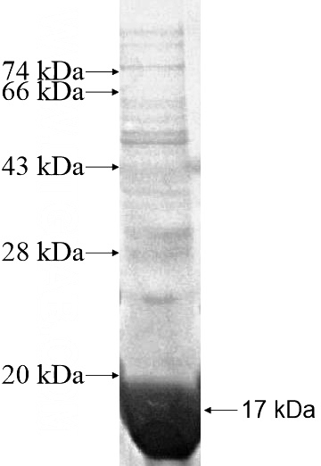 Recombinant Human SPACA3 SDS-PAGE