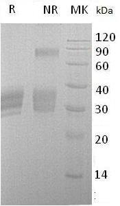 Human LTBR/D12S370/TNFCR/TNFR3/TNFRSF3 (His tag) recombinant protein
