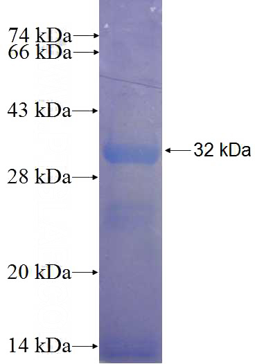Recombinant Human DBF4B SDS-PAGE