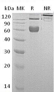 Mouse Tnfrsf9/Cd137/Ila/Ly63 (Fc tag) recombinant protein