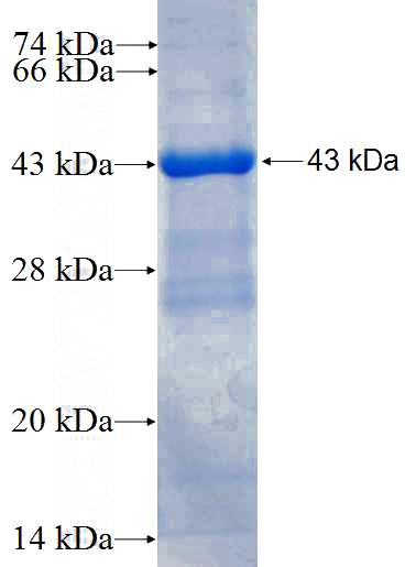 Recombinant Human SIRT3 SDS-PAGE