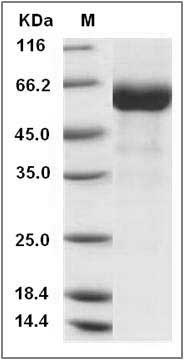 Human IZUMO4 / C19orf36 Protein (Fc Tag) SDS-PAGE