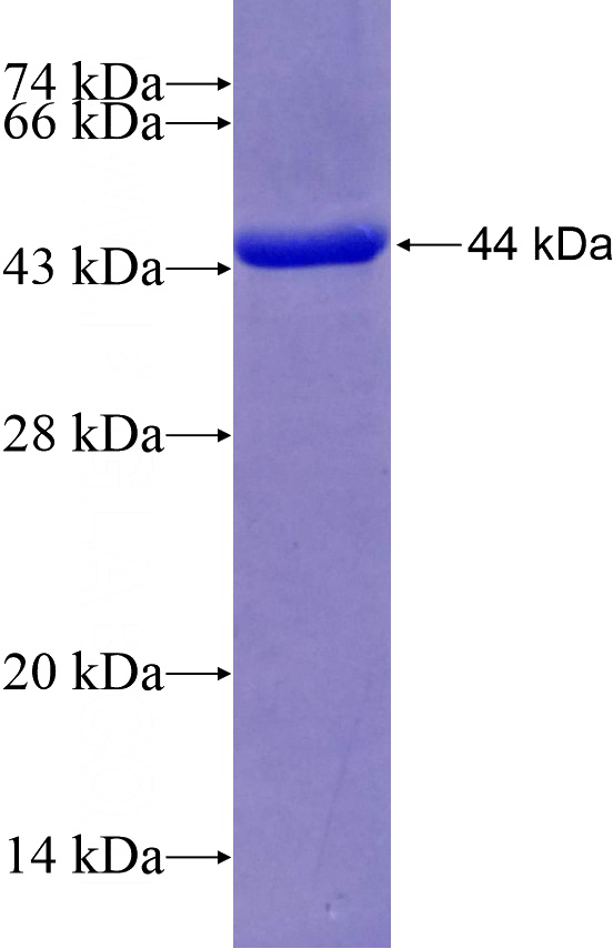 Recombinant Human XPNPEP3 SDS-PAGE