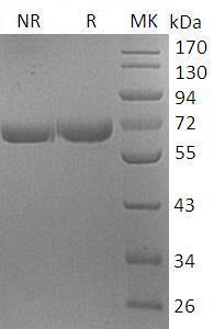 Human PRCP/PCP (His tag) recombinant protein