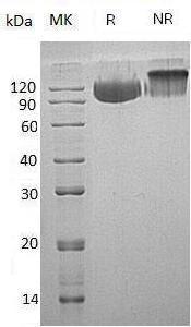 Human SERPING1/C1IN/C1NH (His tag) recombinant protein