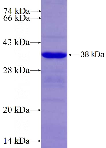 Recombinant Human NOC2L SDS-PAGE