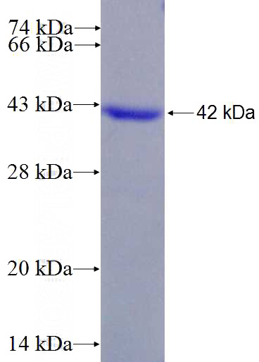 Recombinant Human GRB7 SDS-PAGE