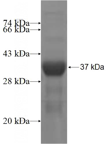 Recombinant Human COL23A1 SDS-PAGE