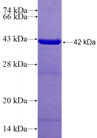 Recombinant Human NAP1L2 SDS-PAGE