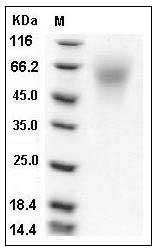 Mouse C4.4A / LYPD3 Protein (His Tag) SDS-PAGE